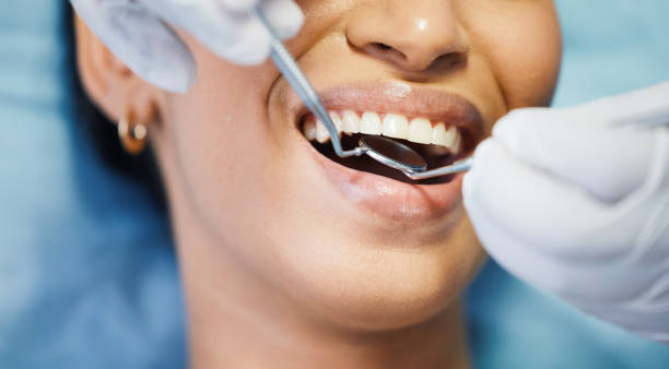 Best Emergency Wisdom Teeth Removal in Dortches, NC